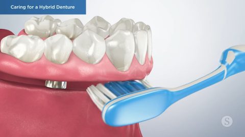 Caring for a Hybrid Denture