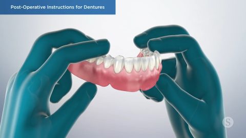 Post-Operative Instructions for Dentures