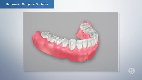 Removable Complete Dentures